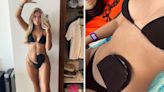 Woman wears bikini to proudly show off her stoma bag and help banish the stigma