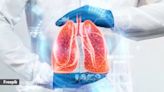 Why lung cancer diagnosis among non-smokers is difficult