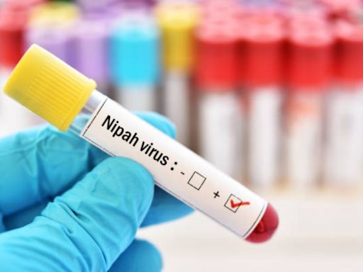 Nipah Virus Outbreak: Kerala On Alert After 14-Year-Old Boy Dies At Kozhikode Hospital