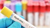 Nipah Virus Outbreak: Kerala On Alert After 14-Year-Old Boy Dies At Kozhikode Hospital