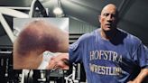 Dwayne Johnson shows massive elbow bruise from ‘The Smashing Machine’ injury, says he is ‘back to work’