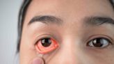 10歲童高燒、眼紅竟患「眼窩蜂窩組織炎」 微創手術救回一命 | am730