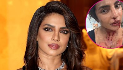 Priyanka Chopra Is Bruised, Bloody on Set of New Movie 'The Bluff'