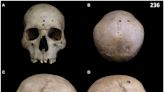 Ancient Egyptian Skull Found Riddled With Tiny Cut Marks. This Could Be Why.