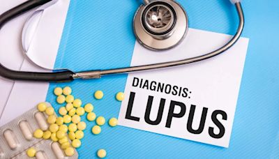 Científicos detectan la causa del lupus y la forma de revertirlo