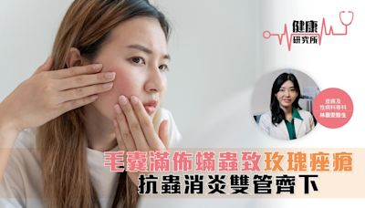 健康研究所｜毛囊滿佈蟎蟲致玫瑰痤瘡 抗蟲消炎雙管齊下 | am730