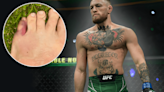 Conor McGregor reveals broken toe forced UFC 303 withdrawal, uncertain about future