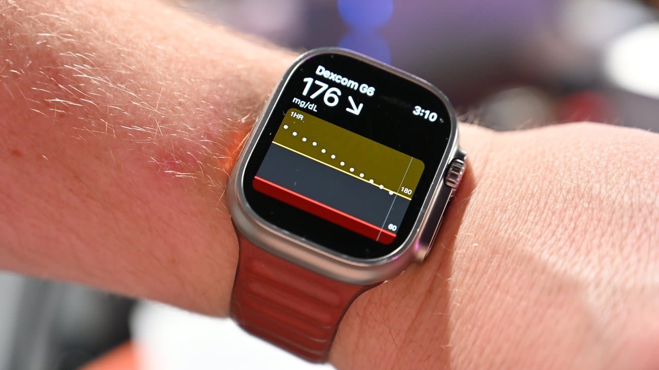 Hands on: Using the Dexcom G7 continuous glucose meter directly with Apple Watch - Apple Watch Discussions on AppleInsider Forums