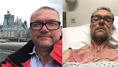 Man diagnosed with rare syndrome after symptoms mistaken for a vitamin B deficiency