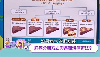 肝癌不同期別治療方式不同