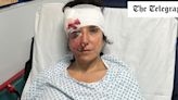 Woman badly injured by cyclist at same spot in London where pensioner was killed