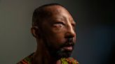 First African American full-face transplant recipient: 'I share what I look like'