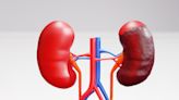 The Latest Breakthroughs That Could Improve Kidney Cancer Treatment