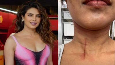 Priyanka Chopra Gets a HUGE Cut on Her Throat While Filming Stunt Scenes For The Bluff; Shares Pic - News18