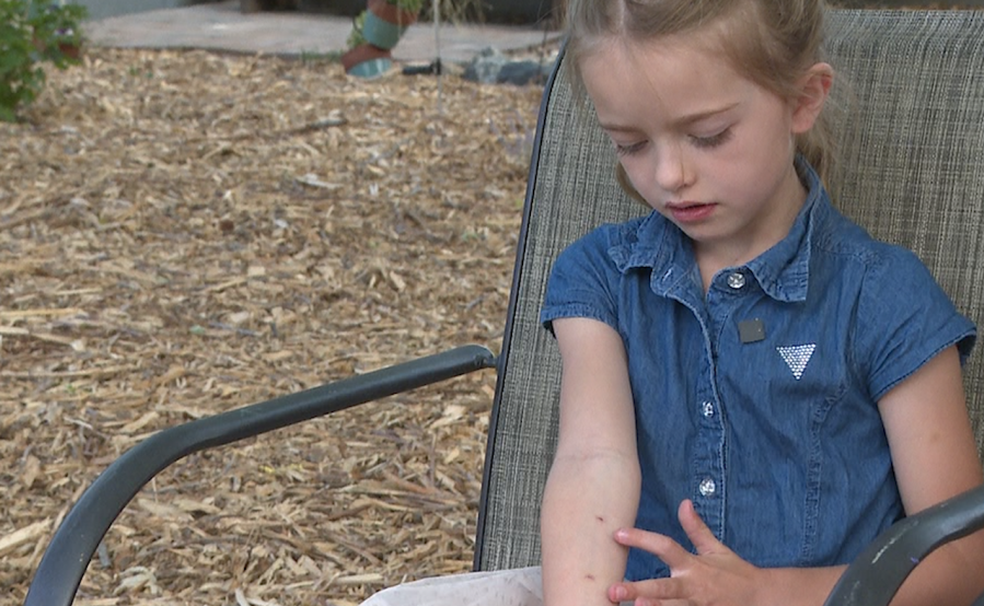 Fort Collins 6-year-old bitten by loose dog that’s now wanted by animal control