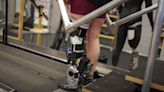 Demuestran la eficiencia de una pierna biónica para caminar más rápido en personas con amputaciones