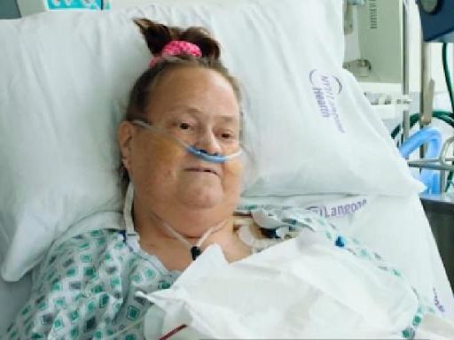 Woman who received pig kidney along with implanted device to keep her heart beating, dies