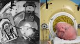 How one man lived in an iron lung for 70 years – and wrote a book with his mouth