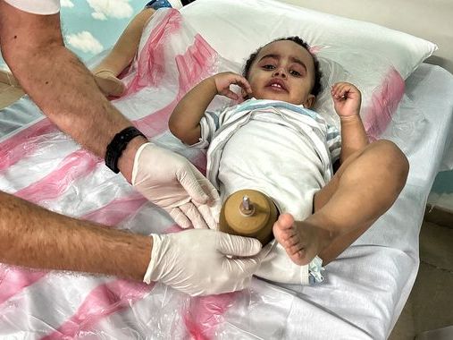 'The doctor told me count to three - and he cut my leg': The generation of Palestinian children with devastating amputations after a year of war