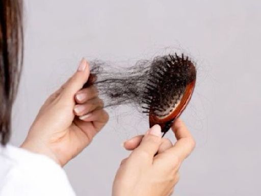 Excessive hair fall during rains causing distress? Here's what you can do about it