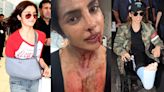Priyanka Chopra Jonas, Alia Bhatt, Kangana Ranaut and other Bollywood divas who got injured on set