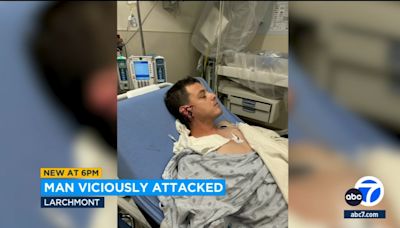 Doctors reattach half of ear that was sliced off in brutal Larchmont attack