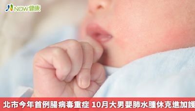 北市今年首例腸病毒重症 10月大男嬰肺水腫休克進加護