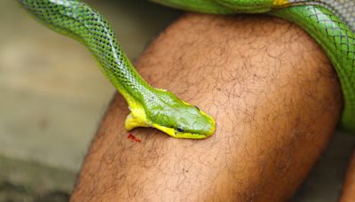 Common blood thinner drug could be possible cheap antidote to treating snakebites: Study