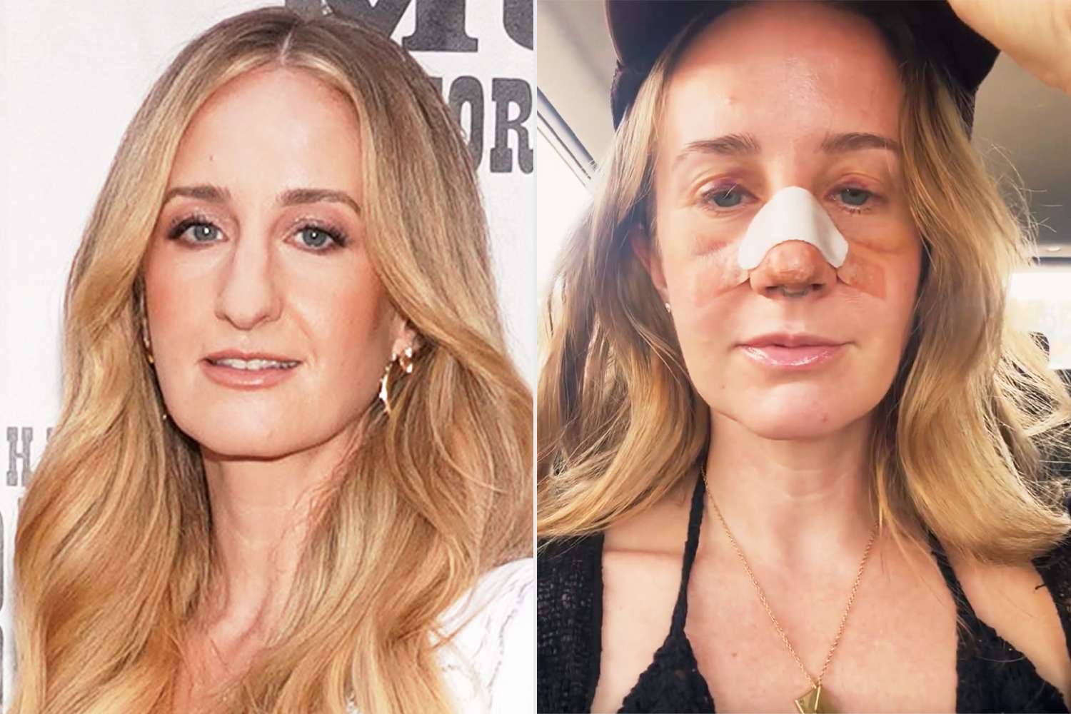 Why Country Singer Margo Price Got a Nose Job: 'I Was Bullied Online Constantly'