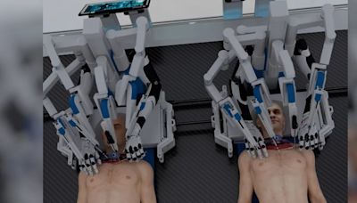 Así se vería un trasplante de cabeza hecho con robots e inteligencia artificial