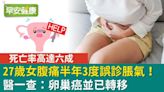 27歲女腹痛半年3度誤診脹氣！醫一查：卵巢癌並已轉移