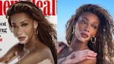 Winnie Harlow is 'a work of art' in new photos, talks inspiring others with vitiligo