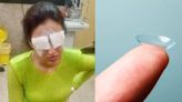 Jasmine Bhasin's Cornea Gets Damages After Wearing Contact Lens; Here Is How Wearing Lenses Can Affect You