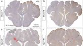 Axons in female mammal brains may be more prone to concussions