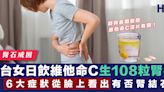 【腎結石】台女日飲維他命C生108粒腎石 6大症狀從臉上看出有否腎結石