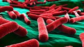 E.coli symptoms, causes and how to avoid the infection