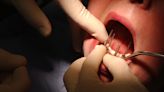 Groundbreaking human trial for tooth regeneration drug set to begin