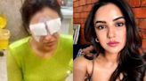 Jasmin Bhasin Says She 'Can't See Properly' After Suffering Corneal Damage