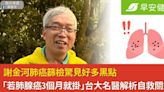 謝金河肺癌篩檢驚見好多黑點「若肺腺癌3個月就掛」台大名醫解析自救關鍵