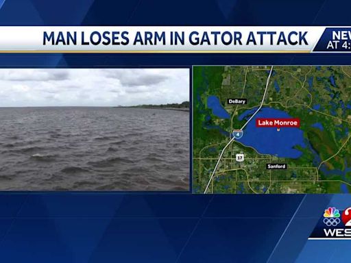 Man has arm amputated after gator attack at Seminole County lake