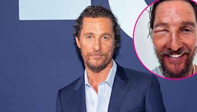 Matthew McConaughey’s Eye Is Swollen Shut After Bee Sting