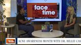 Face Time with Dr. Billie Casse: Acne Awareness Month