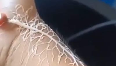 Video Of Ribbon Worm Spitting Out Tree-Like Structure Is Not For Faint-Hearted - News18