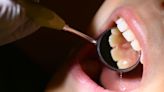 Do you need a dentist visit every 6 months? That filling? The data is weak