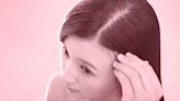 Is The Answer to Flakey Scalps a Follicular Facial?