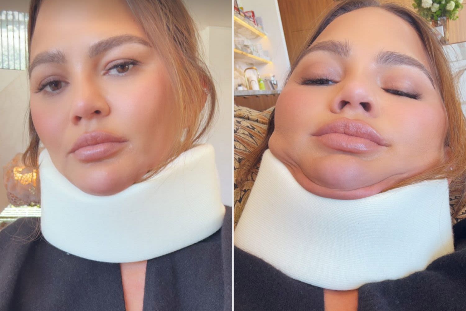 Chrissy Teigen Models a Neck Brace and Jokes She Skipped the 2024 Met Gala Because a Headstand 'Didn’t Go Well'