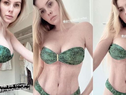 Bárbara Evans mostra o corpo um mês após cirurgias plásticas; veja fotos!