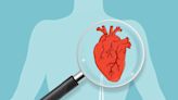 What to Know About Diabetes and the Risk of Silent Heart Attacks