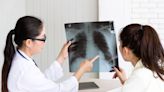 健康網》肺部檢查發現白點是罹癌？醫：大於3公分恐是惡性 - 自由健康網