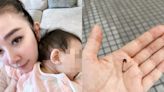 許維恩10月大女兒「誤食別針」 急診醫揭：3物品最常誤吞